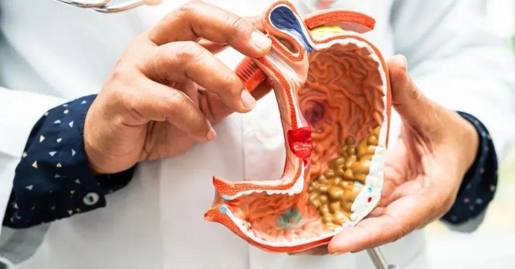 Anatomia dello stomaco: dove si trova.