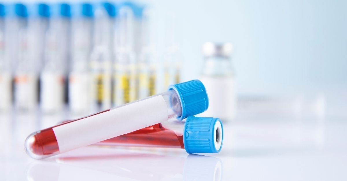 Cos'è l'acido urico