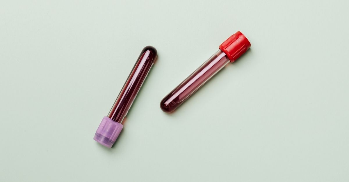 Cos'è l'alanina aminotransferasi