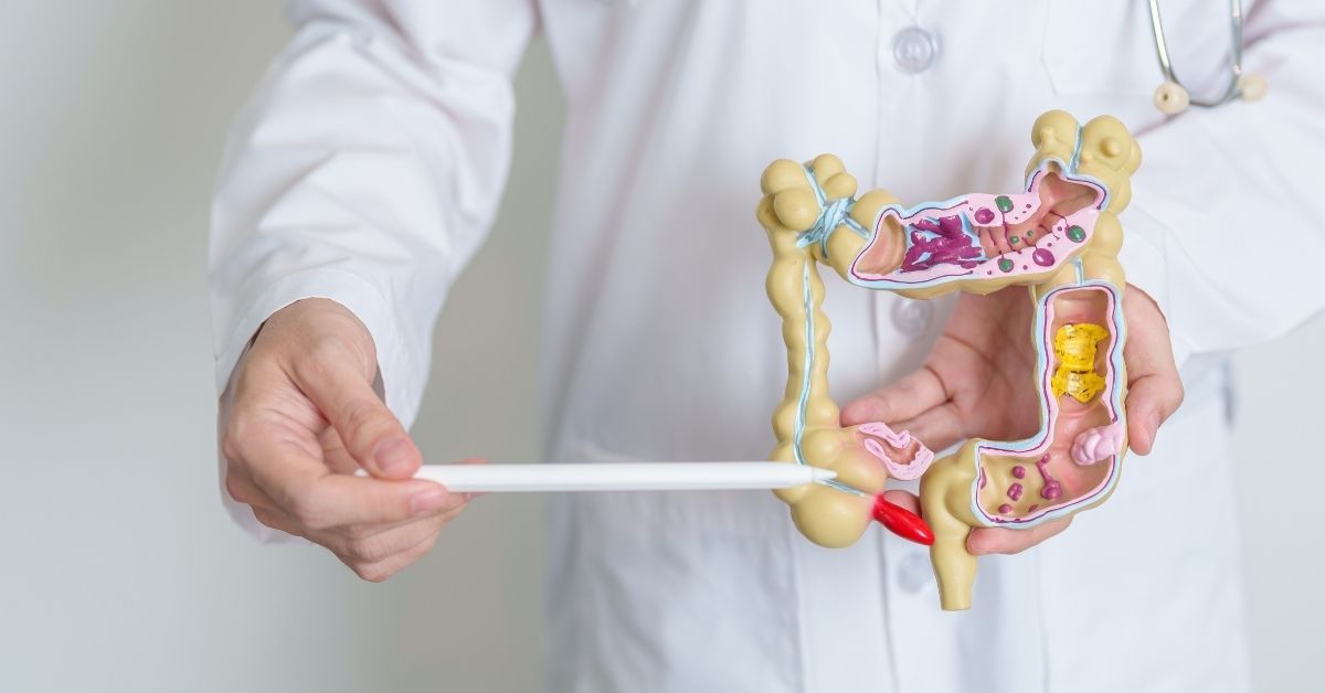 Cos'è la colite ischemica