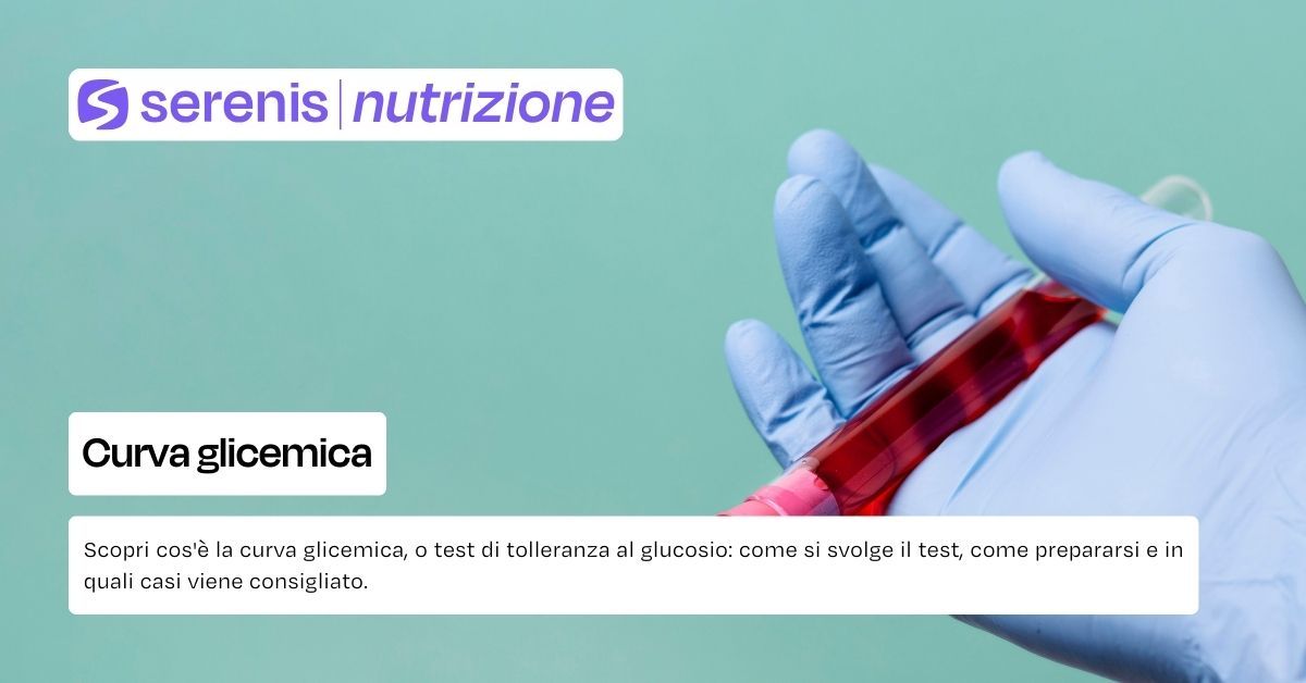 Curva glicemica
