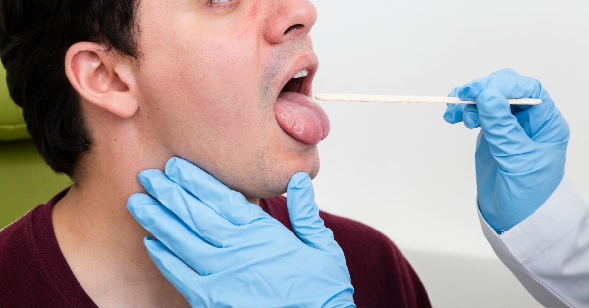 Diagnosi della mononucleosi: monotest