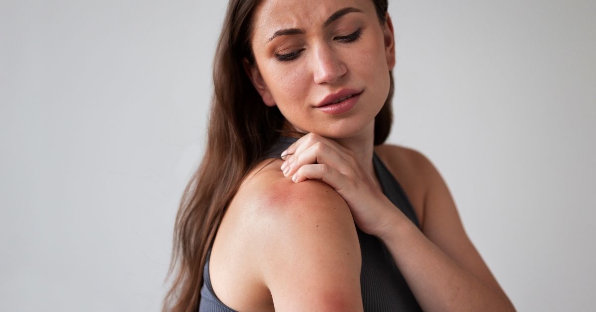 Eczema nummulare cause