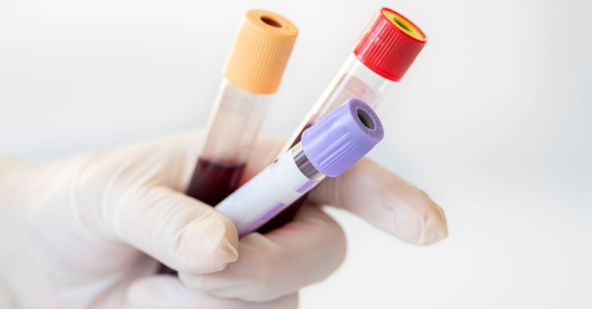 Esame dei basofili alti