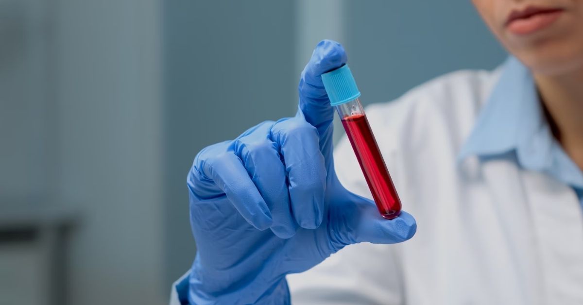 Esame dei nitriti nelle urine: valori e quando preoccuparsi