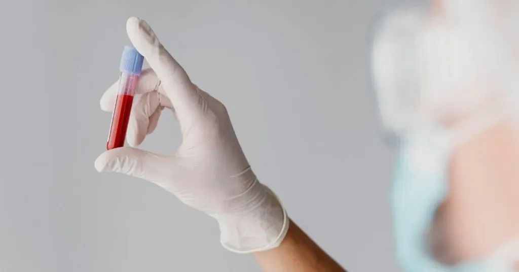 Esami del sangue con o senza ricetta