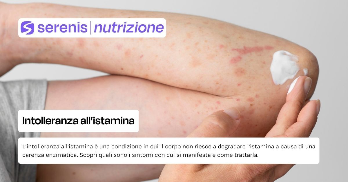 Intolleranza all'istamina