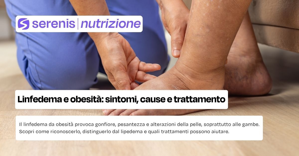 Linfedema e obesità