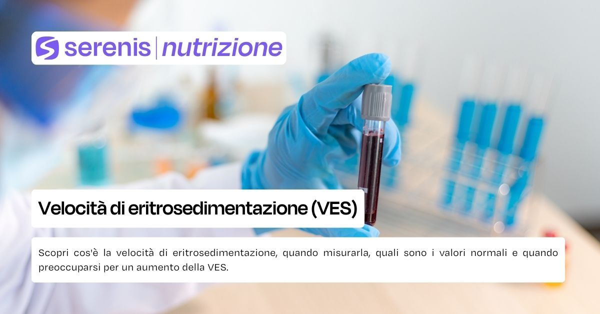 Velocità di eritrosedimentazione o VES