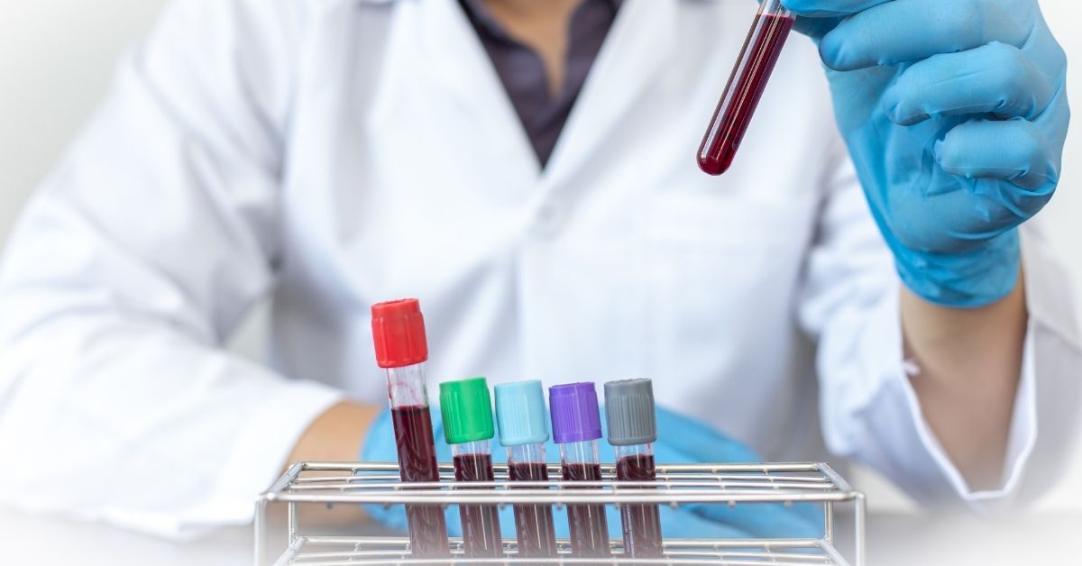 clearance della creatinina