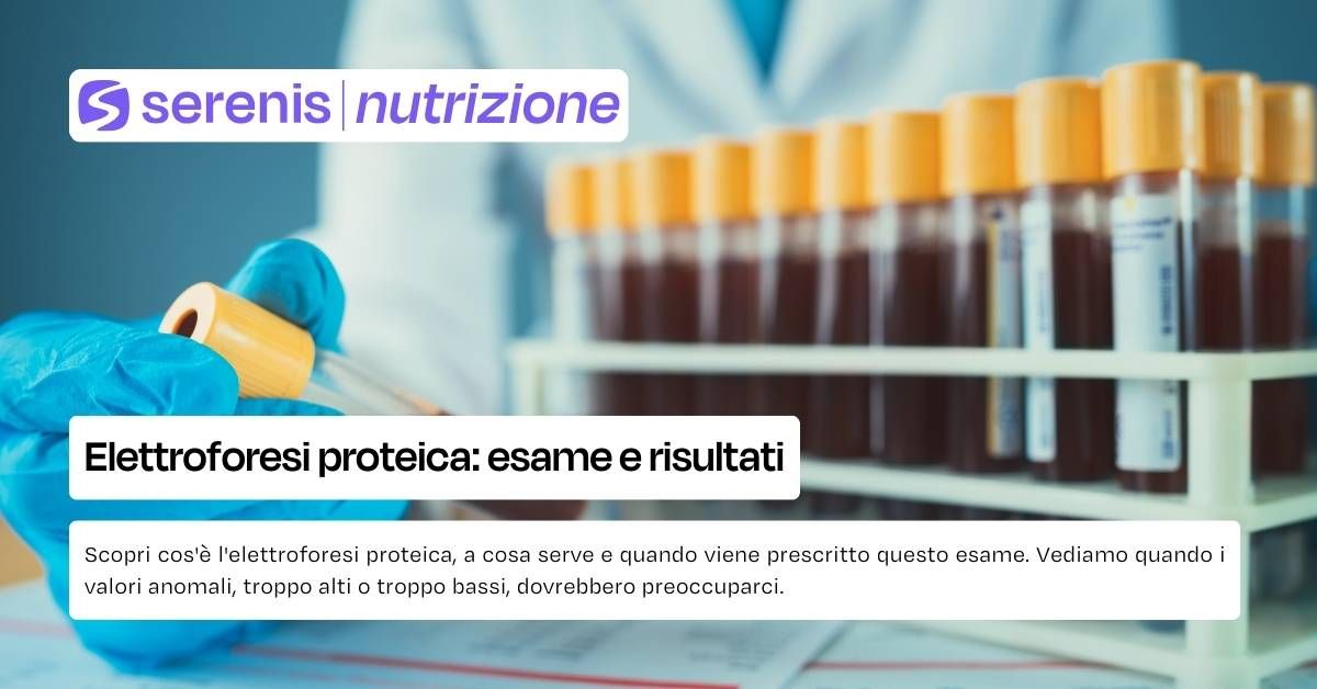elettroforesi proteica
