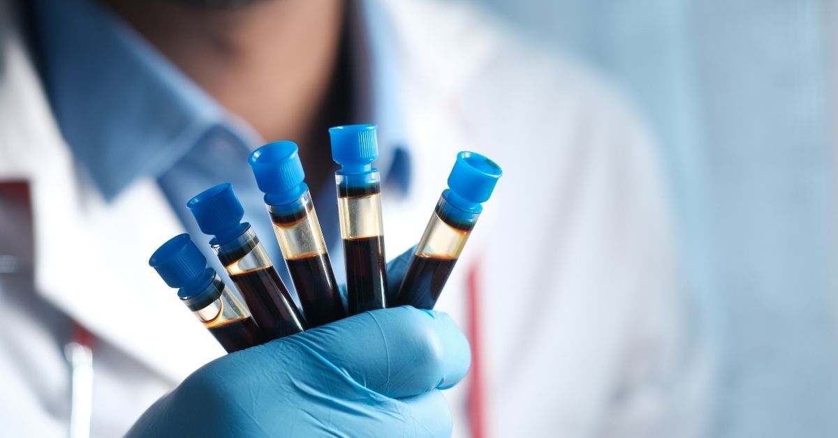 esami sangue per fibromialgia