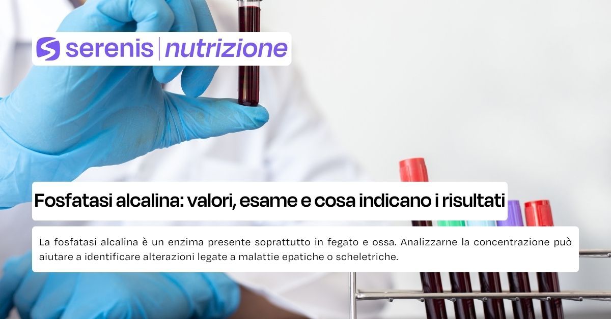 fosfatasi alcalinica