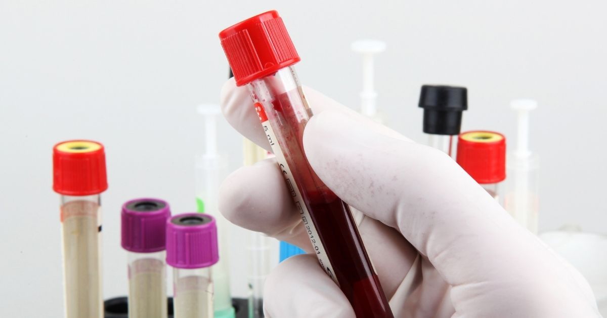 Globuli bianchi bassi sintomi