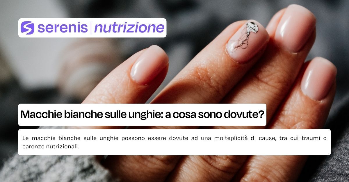macchie bianche sulle unghie