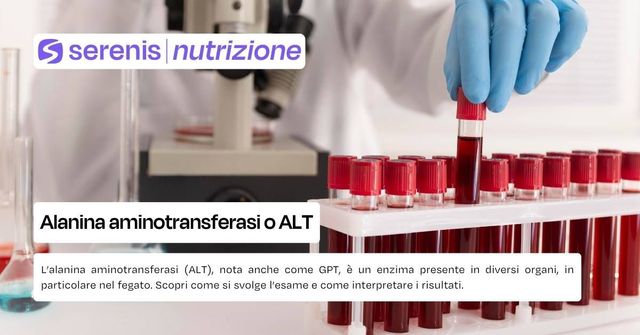 Alanina aminotransferasi o ALT