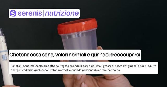 chetoni