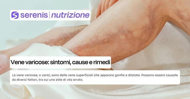 vene varicose
