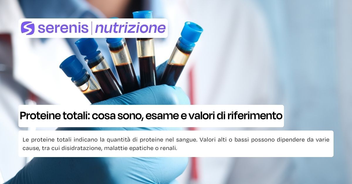 proteine totali 