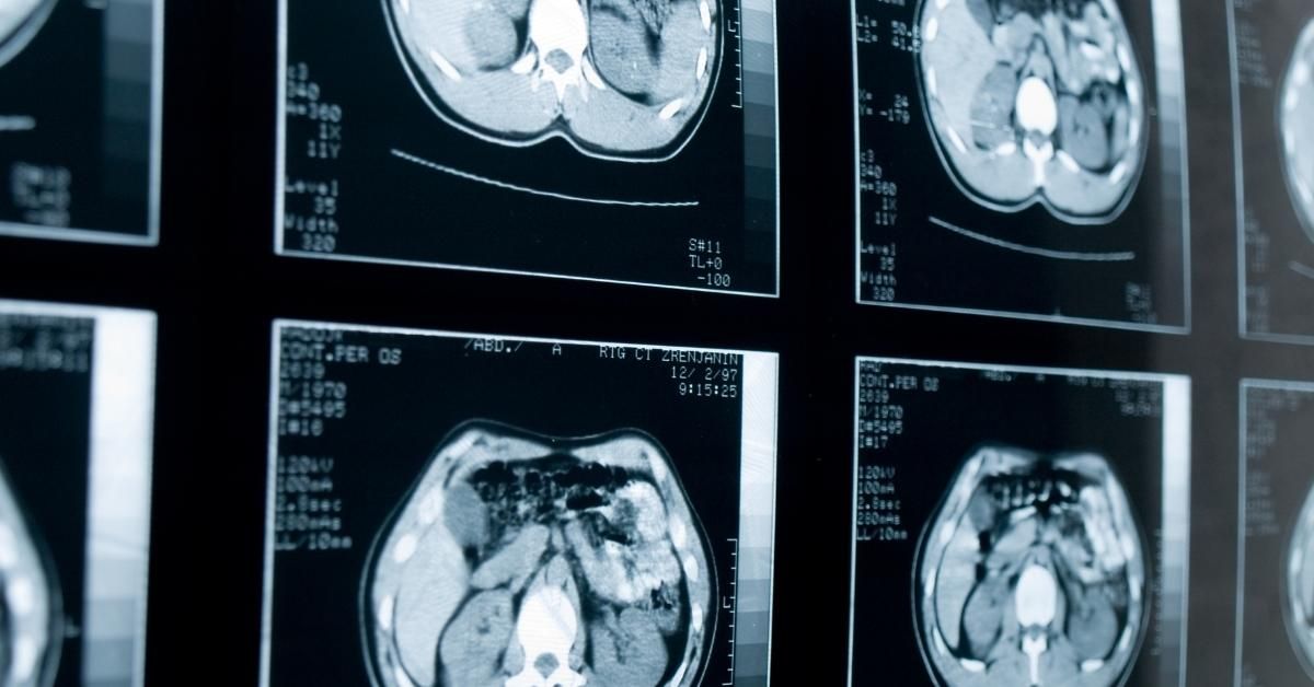 risonanza magnetica prezzo