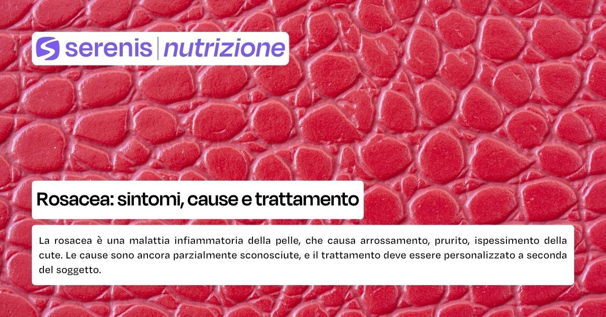 rosacea