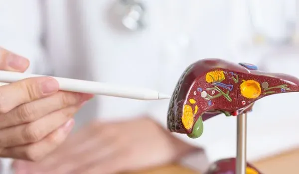 steatosi epatica non alcolica