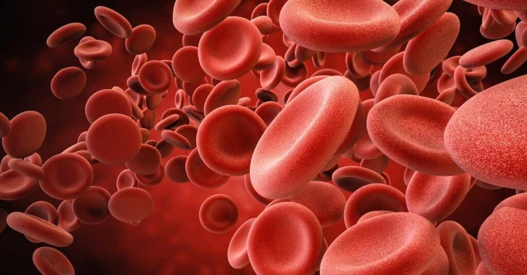 Anemia emolitica autoimmune